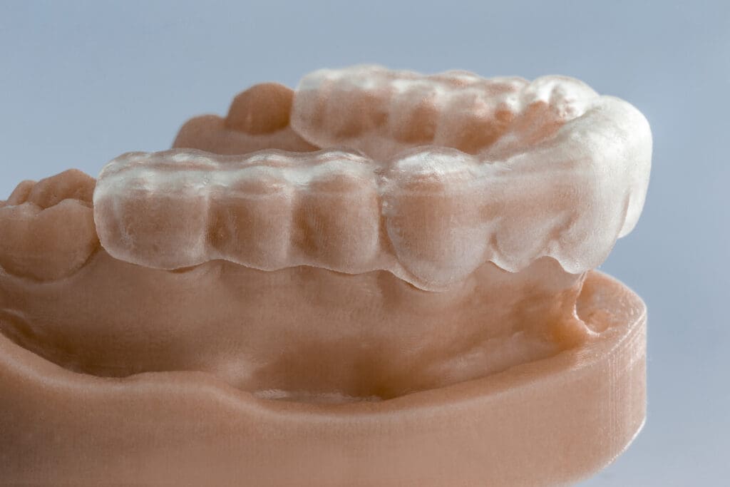 ICON + 3D Printed InHouse Bleach Trays Digital Workflow = More Revenue