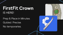 single visit dental crown
