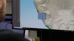 orthodontic specialty appliances