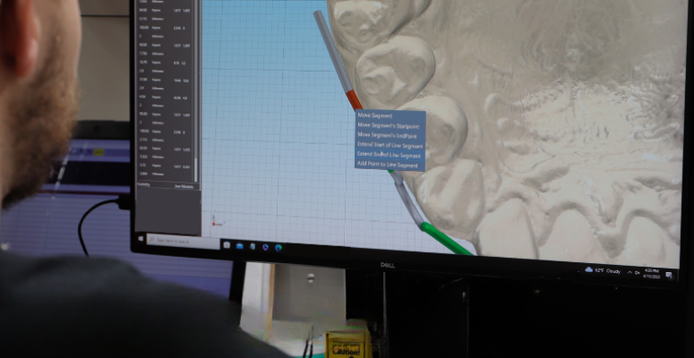 orthodontic specialty appliances