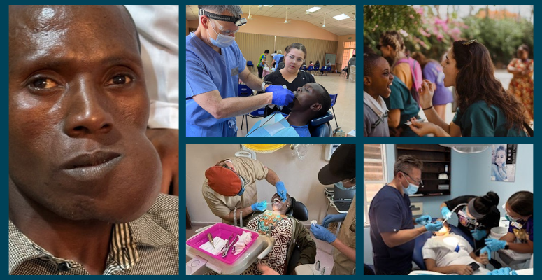 U.S. Oral Surgery Management (USOSM) Mission Trip