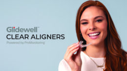 clear aligners